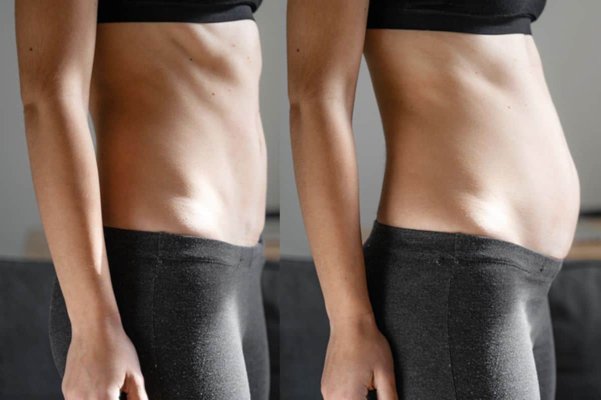 How long does diastasis recti take to improve Old Trafford?
