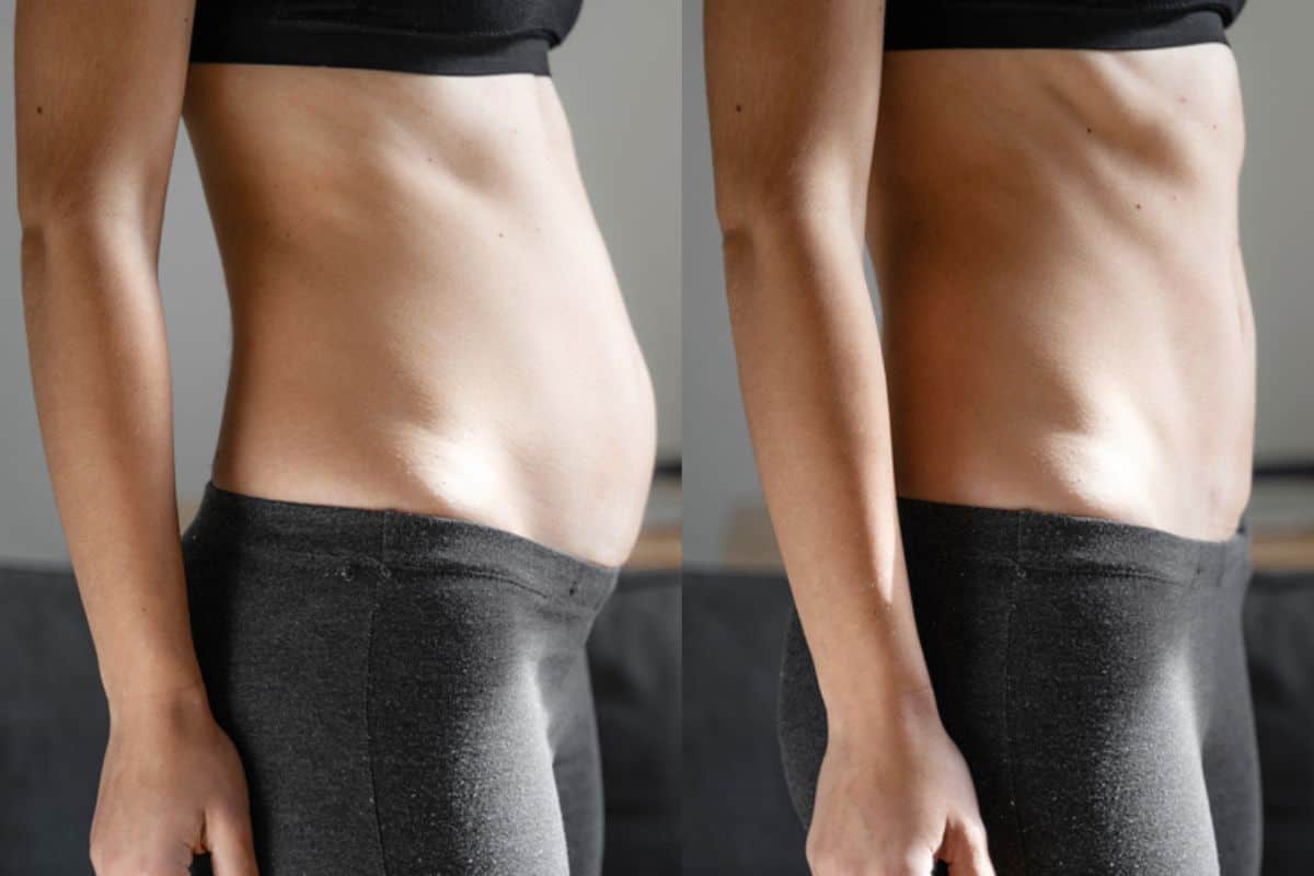 Post-Pregnancy: What Happens to Your Abdominal Muscles After Birth Old Trafford