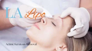 Woman receiving Actinic Keratosis Removal Treatment Old Trafford