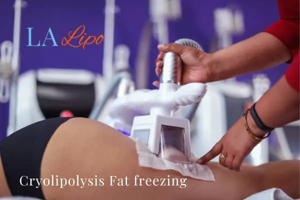 women getting fat freezing Old Trafford