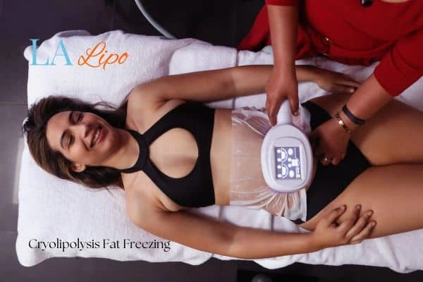 woman getting cryolipolysis Old Trafford