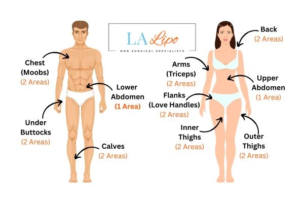 LA LIPO Cryolipolysis Areas Old Trafford