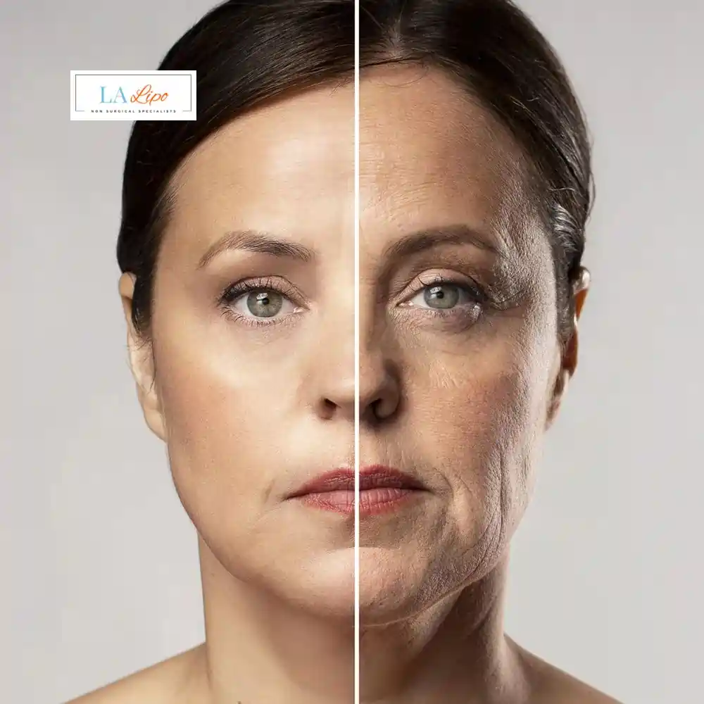 How Can You Tell If Non-Surgical Skin Tightening Is Right for You Old Trafford?