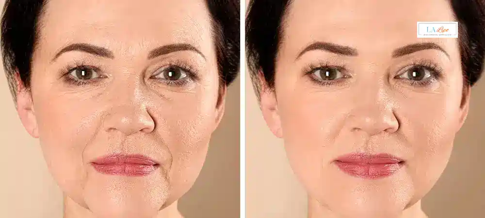 How Long Does It Take to See Results and How Long Do They Last Old Trafford?