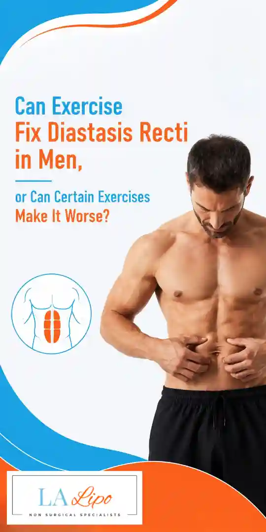 Can Exercise Fix Diastasis Recti in Men, or Can Certain Exercises Make It Worse Old Trafford?